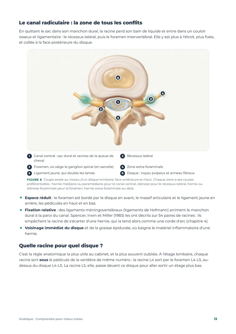 Page du chapitre 2 : la coupe axiale et les quatre zones où une racine peut être irritée